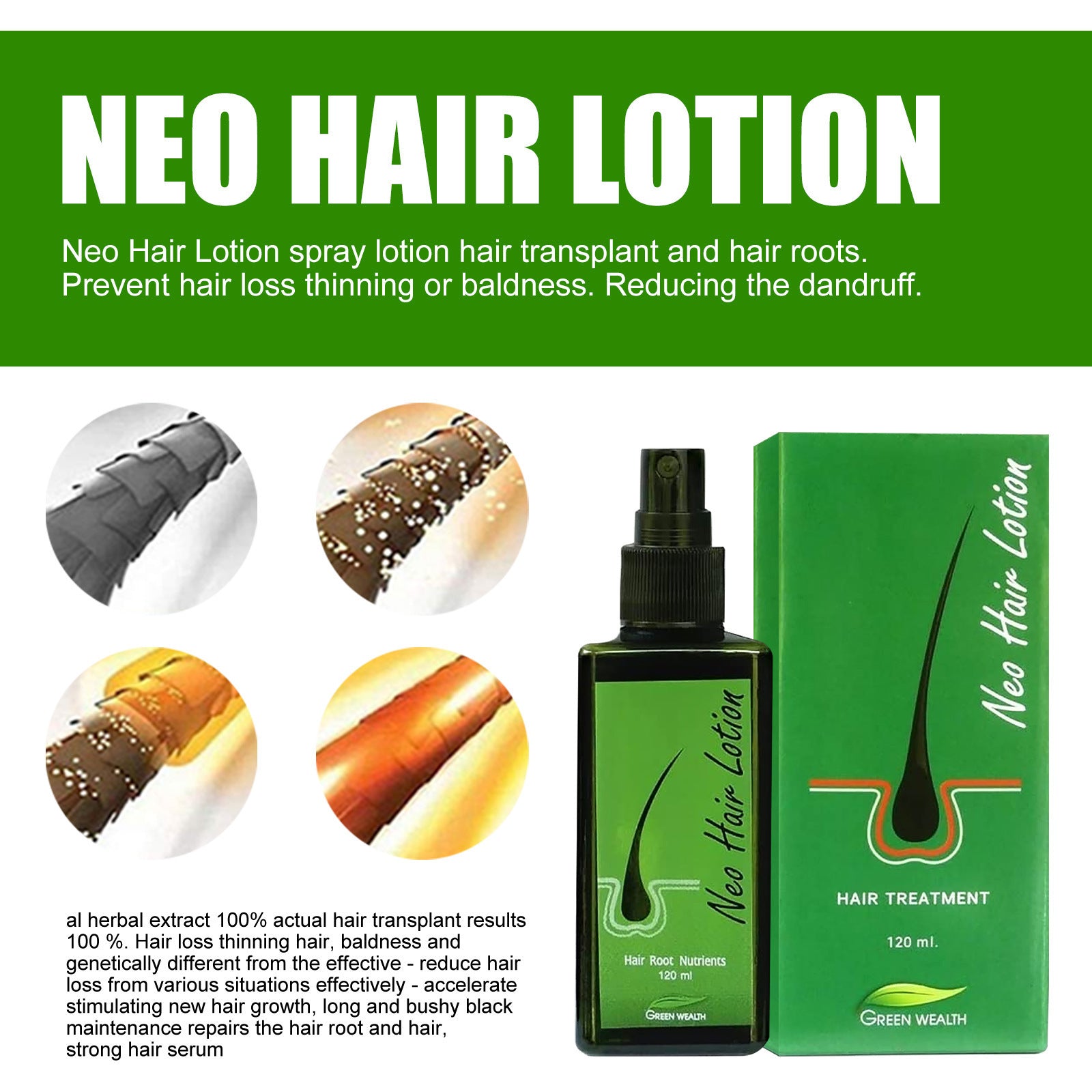 Hair Care Growth Lotion Spray Hair Care Growth Lotion Spray